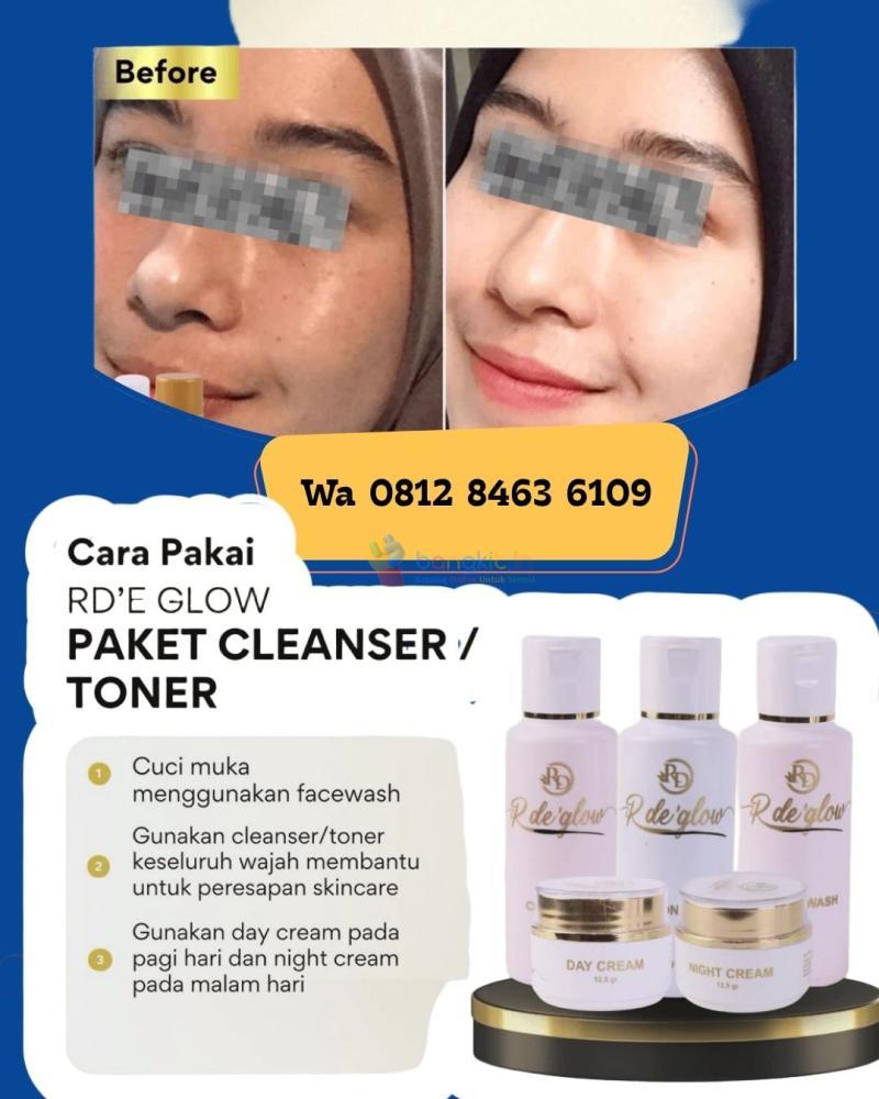 paket skincare rd glow untuk flek hitam di wajah- o8i2-8463-6IO9, Purworejo  - Jawa Tengah